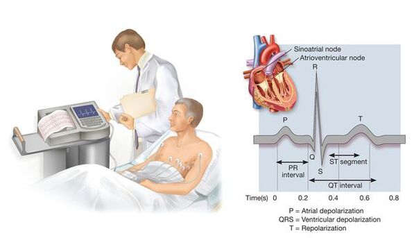 Ηλεκτροκαρδιογραφία για την ανίχνευση καρδιαγγειακών παθήσεων στην υπέρταση